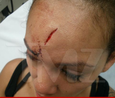  photo 0617-evelyn-lozada-injuries-wm-3-480w_zps2cd0c6be.jpg