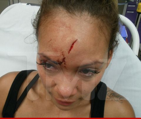  photo 0617-evelyn-lozada-injuries-wm-4-480w_zpsf4475ff1.jpg