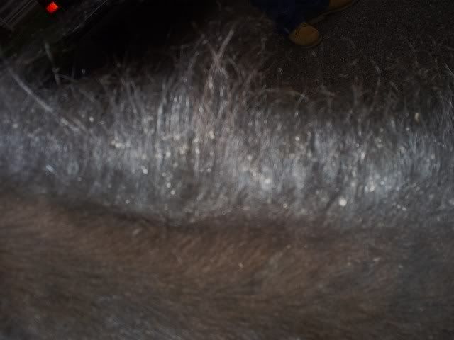 dry+skin%3F+dandruff%3F+lice%3F.